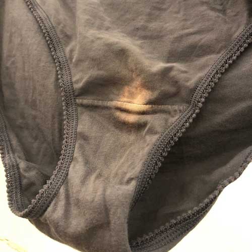 Why Stains on the Underwear?